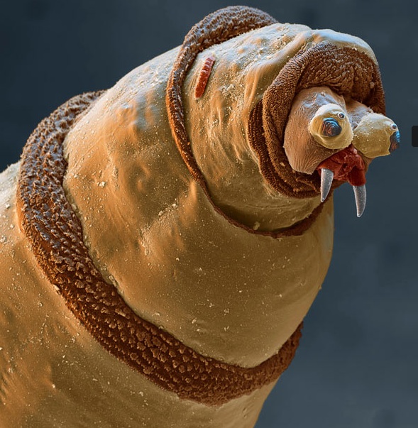 A scanning electron micrograph of the head of maggot. These maggots are used to clean wounds.